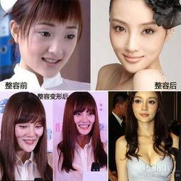 西安整容爆料事件視頻最新,揭秘行業(yè)亂象，患者權(quán)益引關(guān)注